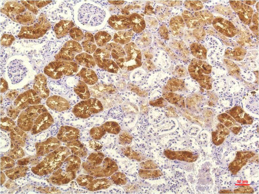 IL-8 Monoclonal Antibody (8B1)
