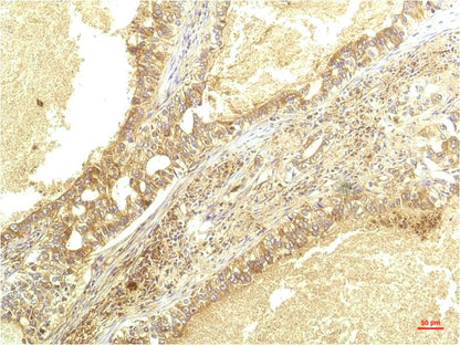 IL-8 Monoclonal Antibody (8B1)