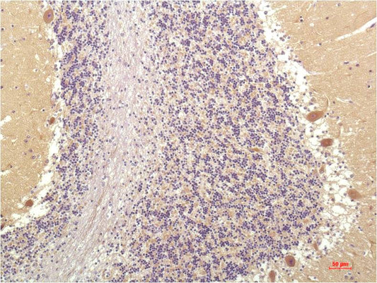SGK1 Monoclonal Antibody (4D12)