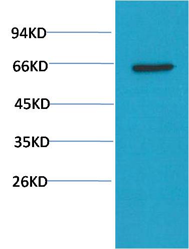 Akt Monoclonal Antibody (10D6)