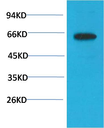 Akt (Phospho Ser473) Monoclonal Antibody (6F8)