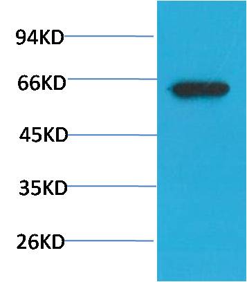 Akt (Phospho Ser473) Monoclonal Antibody (7F9)