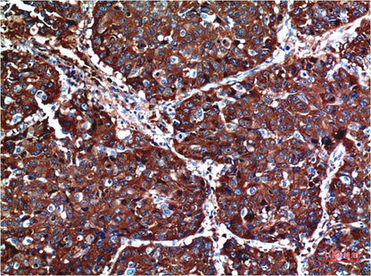 Akt Monoclonal Antibody (1H2)