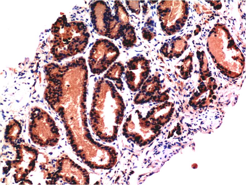 Caspase-3 Monoclonal Antibody (5H10)