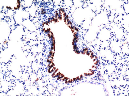 TGFBeta1 Monoclonal Antibody (5D2)