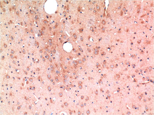 TGFBeta1 Monoclonal Antibody (10E5)