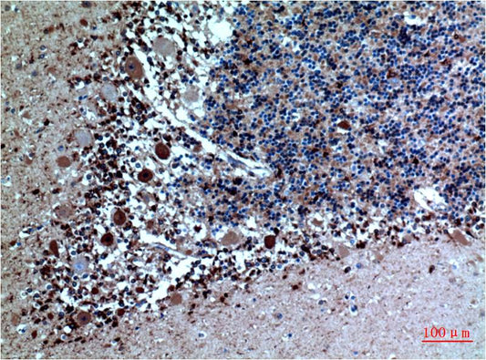 Cystatin C Monoclonal Antibody (5A2)