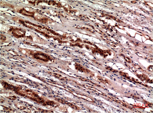 Cystatin C Monoclonal Antibody (5F1)