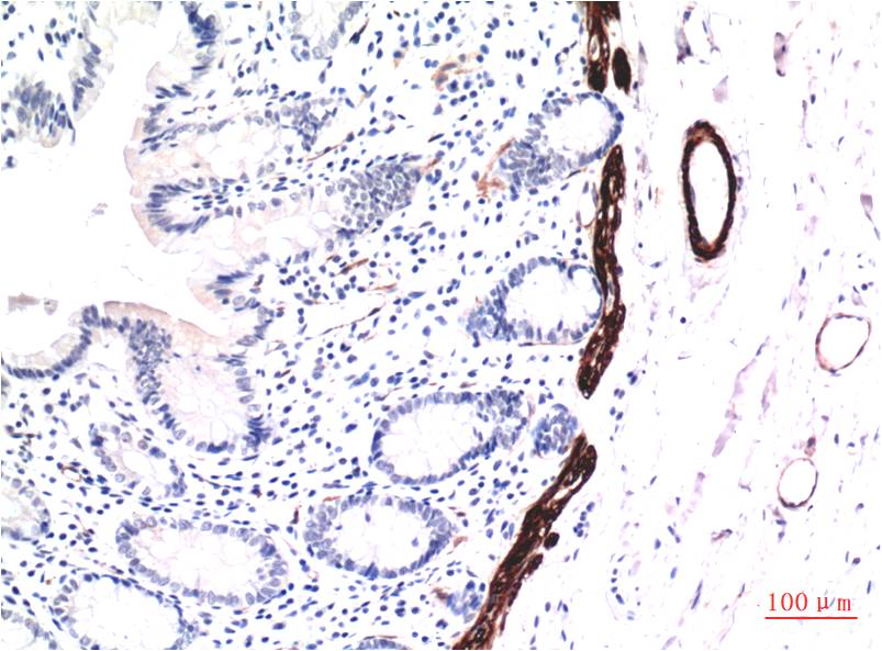 Muscle Actin Monoclonal Antibody (1E9)