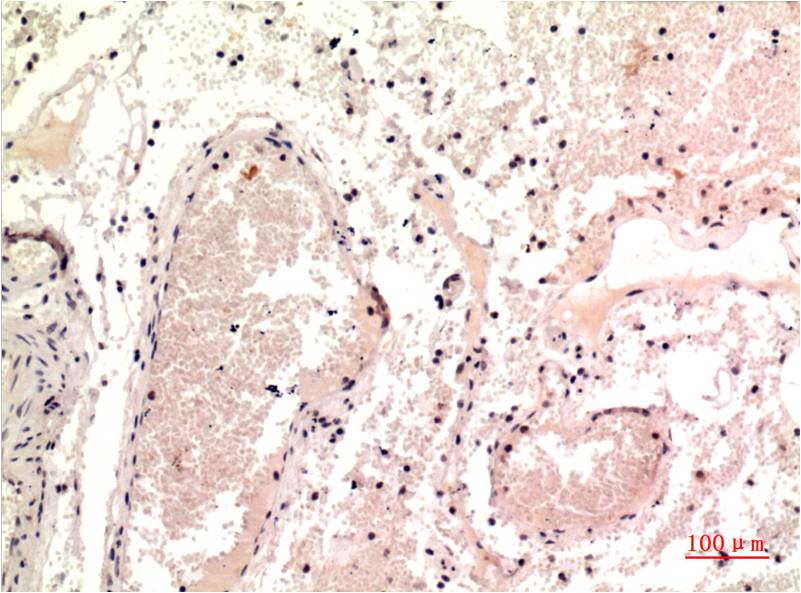 Gamma Tubulin Monoclonal Antibody (7C1)