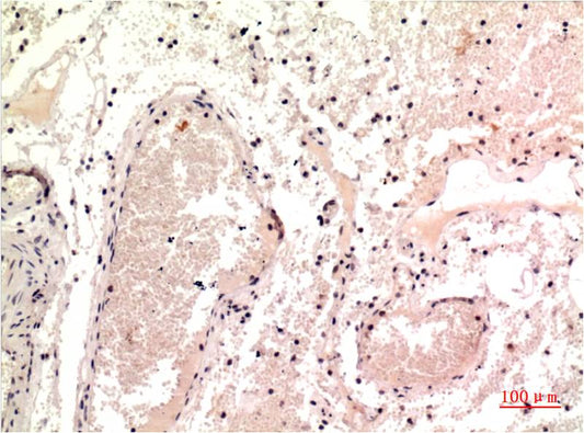Gamma Tubulin Monoclonal Antibody (7C1)