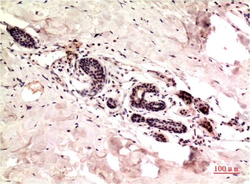 Gamma Tubulin Monoclonal Antibody (7C1)