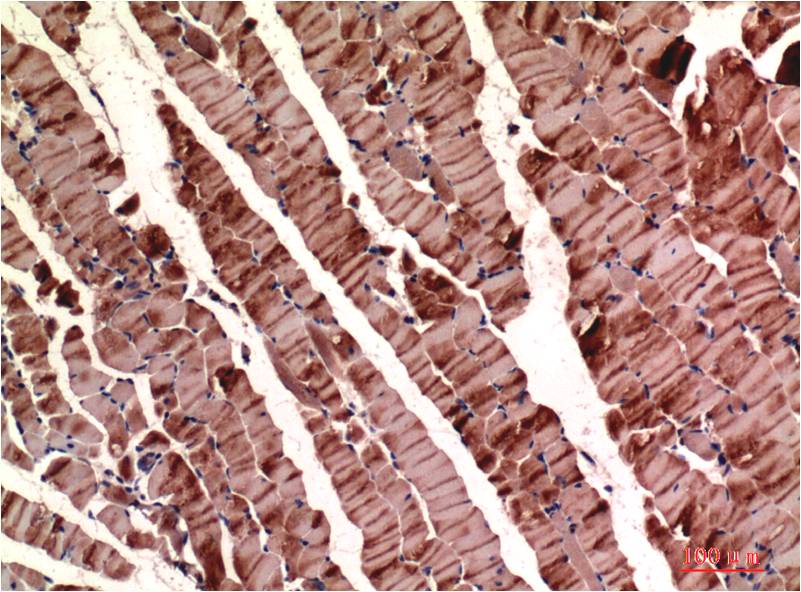 Muscle Actin Monoclonal Antibody (2H3)