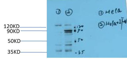 STAT3 (Phospho Y705) Monoclonal Antibody (1E9)