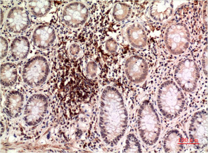 Epsilon Tubulin Monoclonal Antibody (3G1)
