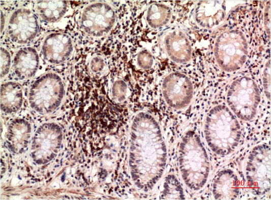 Epsilon Tubulin Monoclonal Antibody (3G1)