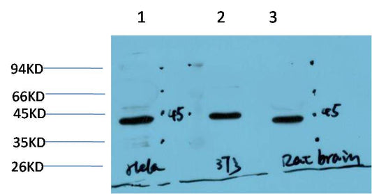 Muscle Actin Monoclonal Antibody (3E9)
