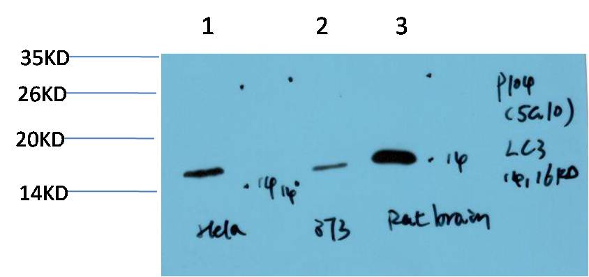 LC3A Monoclonal Antibody (5G10)