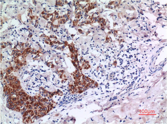 Smad3 Monoclonal Antibody (1E8)