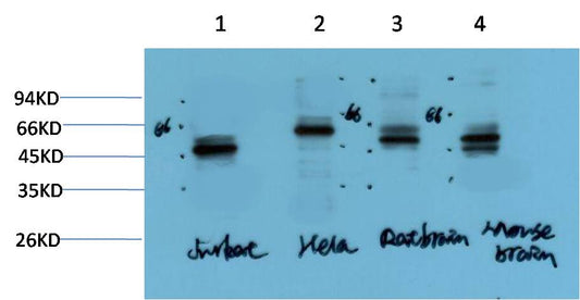Gamma Tubulin Monoclonal Antibody (7B1)