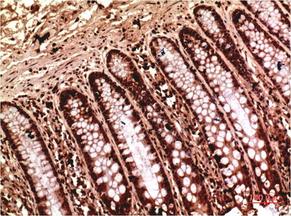 Gamma Tubulin Monoclonal Antibody (7B1)