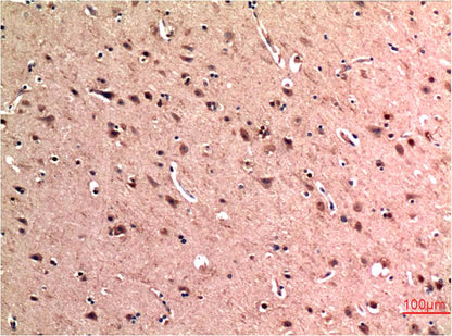 Beclin-1 Monoclonal Antibody (5C2)