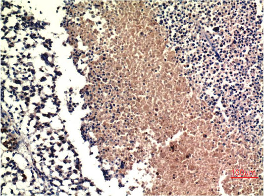 PTEN Monoclonal Antibody (9E8)