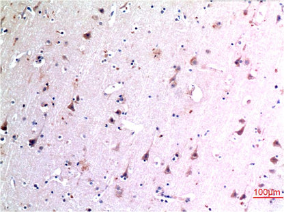 Beclin-1 Monoclonal Antibody (5A11)