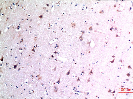 Beclin-1 Monoclonal Antibody (5A11)
