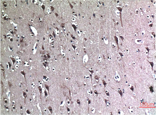 Beclin-1 Monoclonal Antibody (5C5)