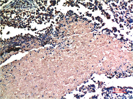 Akt Monoclonal Antibody (1E11)