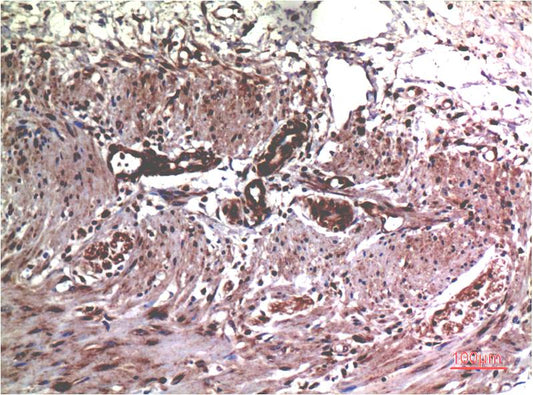 MMP2 Monoclonal Antibody (1H1)