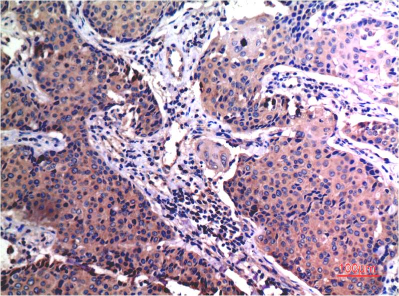 MMP2 Monoclonal Antibody (1H1)
