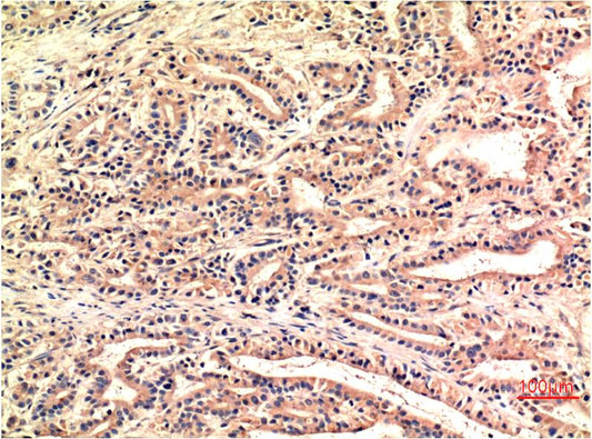 CHOP Monoclonal Antibody (1E1)