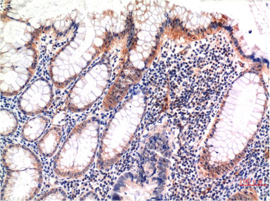 MLKL (Phospho Ser358) Monoclonal Antibody (6F8)