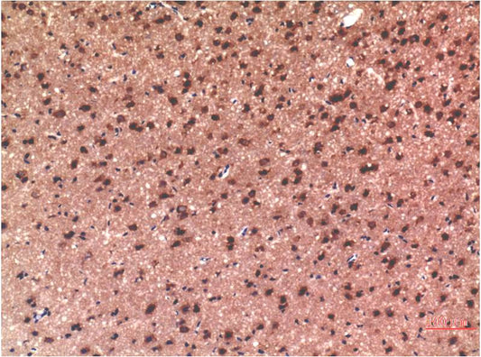 Tau Monoclonal Antibody (10E3)