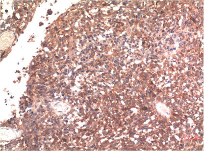 Tau Monoclonal Antibody (10E3)
