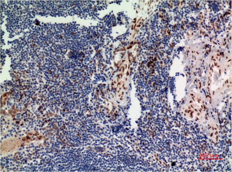 P44 MAPK (ERK1) Monoclonal Antibody (4G11)