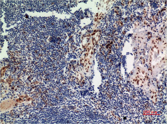 P44 MAPK (ERK1) Monoclonal Antibody (4G11)