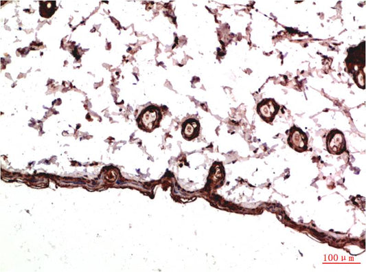 PDGFRAlpha Monoclonal Antibody (7A3)