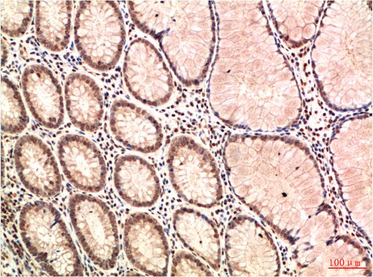 ATM Monoclonal Antibody (4G9)