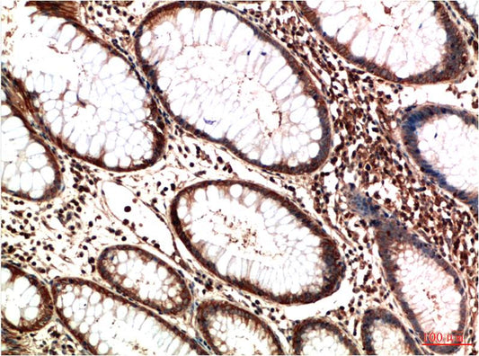 ATM Monoclonal Antibody (3D3)
