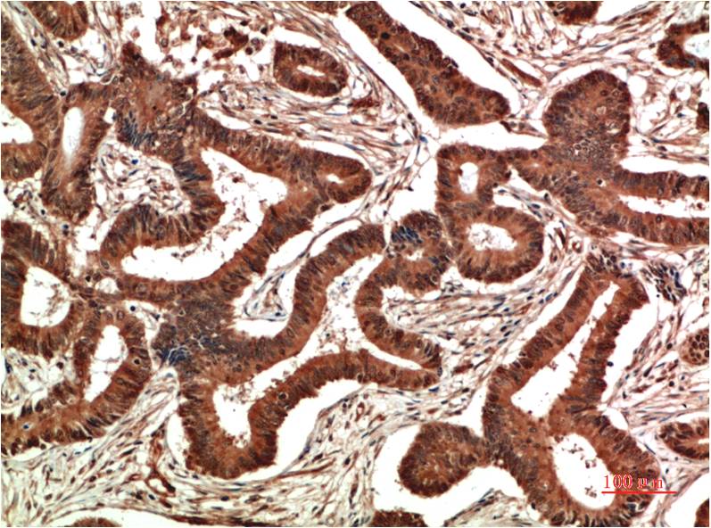 COX2 Cyclooxygenase 2 Monoclonal Antibody (6A12)