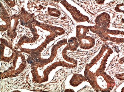 COX2 Cyclooxygenase 2 Monoclonal Antibody (6A12)