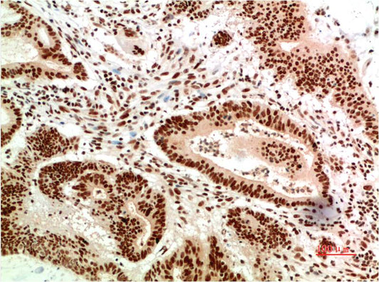 ATM Monoclonal Antibody (6B6)