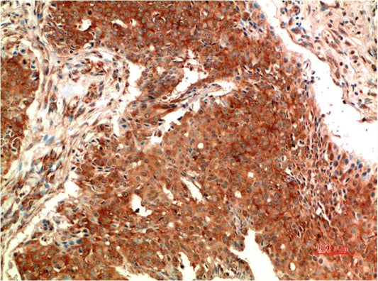ATM Monoclonal Antibody (4C8)