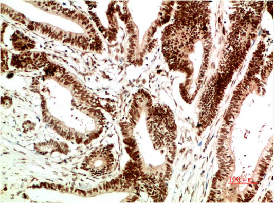 ATM Monoclonal Antibody (1A9)