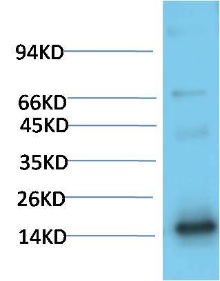 TTR Monoclonal Antibody (1D7)