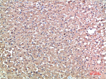 TTR Monoclonal Antibody (1D7)