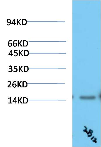 TTR Monoclonal Antibody (2B12)